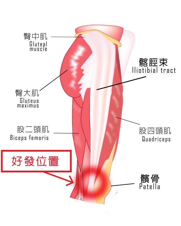 Xuan瘋運動教室/運動不傷膝蓋/膝蓋保健/膝蓋痛/運動膝蓋